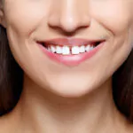 a woman having gap between teeth